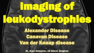 Imaging of Leukodystrophies part 1 Alexander disease Canavan disease and Van Der Knaap Disease [upl. by Nnylrefinnej234]