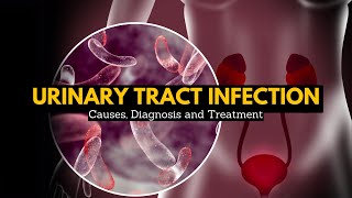 Urinary Tract Infection Causes Signs and Symptoms Diagnosis and Treatment [upl. by Lertnahs]