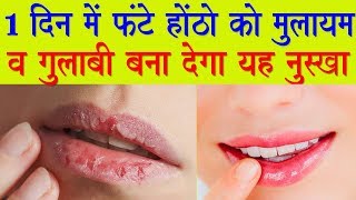 In Just 1 Day Cracked Lips to Get Soft Pink Lips Cracked Lips Homemade Solutions in Hindi [upl. by Clifton907]