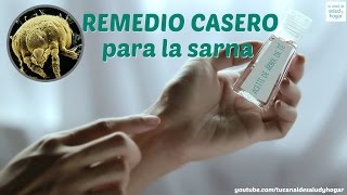 Remedio casero para la sarna [upl. by Savage]