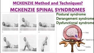 spinal syndrome manual therapy mechanize [upl. by Enobe388]