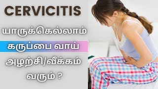 CERVICITIS TREATMENT யாருக்கெல்லாம் கருப்பை வாய் அழற்சிவீக்கம் வரும் [upl. by Kesia]