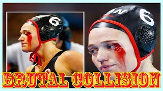 Shocking Olympic Water Polo Injury Blood Pours from Eye After Brutal Collision [upl. by Are]