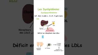 Retenez les Différentes Dyslipidémies sans Effort grâce à cette Méthode Mnémotechnique shorts [upl. by Suoicerp]