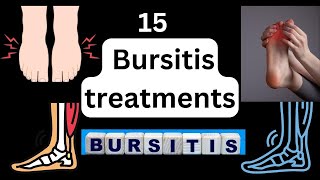 15 Bursitis treatments  heel bursitis amp achilles tendon bursitis best home treatment [upl. by Liek]