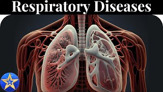 Respiratory Diseases Causes Diagnosis and Treatment [upl. by Herzen968]