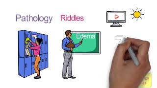 Edema Pathophysiology Part  1 Definition Physiology of Microcirculation  How Does Edema Occur [upl. by Medorra435]