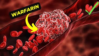 The Ultimate Guide to Understanding Warfarin Its Benefits and side effects [upl. by Bilicki397]