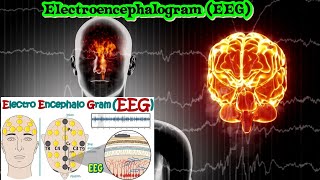 Electroencephalography EEG  How Electroencephalogram test works  What conditions can EEG diagnos [upl. by Konstantine]