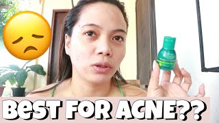 BEST FOR ACNE MAXIPEEL NO 1 First Impression  Demo [upl. by Miner98]