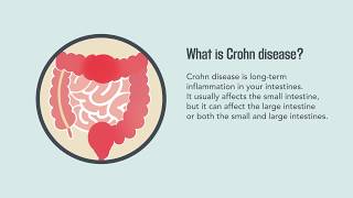 Crohn Disease Signs Symptoms Causes and Treatment  Merck Manual Consumer Version [upl. by Elset]