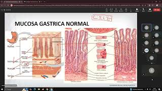 SEMINARIO Mucosa Gástrica 12  Dr Nieves [upl. by Halli552]