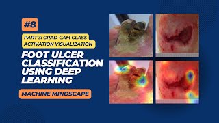 8  Image Classification Using Python  Foot Ulcer  Part 3  GRADCAM Visualisation [upl. by Goldarina459]