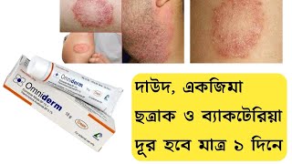 Omniderm Cream এর কাজ কি  দাউদ একজিমা চুলকানি ছত্রাক ও ব্যাকটেরিয়া দূর করার ভালো ক্রিম [upl. by Cindy43]