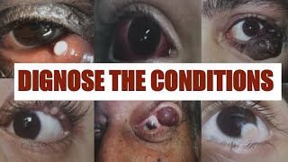 PATHOLOGICAL EYE CONDITIONS 1 Ophthalmology Osce [upl. by Ted]