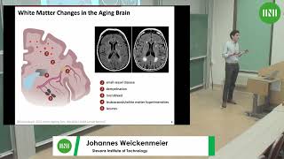 Dr Johannes Weickenmeier  A multiphysics model to predict periventricular white matter [upl. by Pattie]