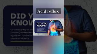 Acid reflux GERD symptoms and treatment [upl. by Ajidahk]