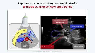 Abdominal Aorta Ultrasound The SMA Radcliffe Vascular [upl. by Keraj]