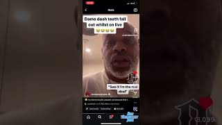 Dame Dash Teeth Falls Out On Live [upl. by Domph]