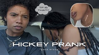 hickey prank on my gf  GONE WRONG [upl. by Chalmers902]