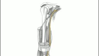 Nerves and Neuropathies of the Upper Limb [upl. by Ardnahcal]