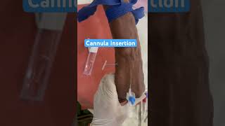 Cannula insertion of old female patient shorts cannula nurses subscribe doctor neet mbbs [upl. by Canice]