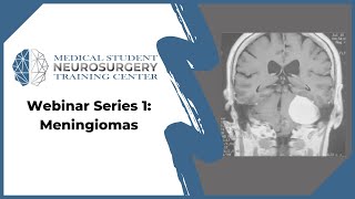 Webinar Series 1 Meningiomas [upl. by Rudolfo395]