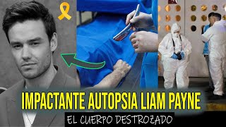 LA IMPACTANTE AUTOPSIA AL CUERPO DE LIAM PAYNE quotNO USÓ LAS MANOS EL CUERPO DESTROZADOquot [upl. by Rapp908]