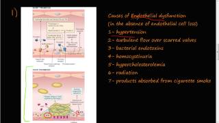 53  Thrombosis Virchows triad Endothelial Injury [upl. by Tallia]