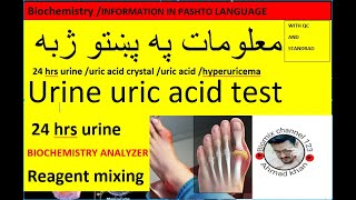 Urine uric acid testuric crystaluricase pap methoduric acid synthesisstone in pashto [upl. by Dasteel]