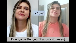 Amanda  Doença de Behçet Vasculite autoimune [upl. by Bonney]