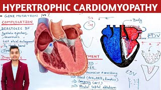 Hypertrophic cardiomyopathy pathophysiology in hindi [upl. by Lora]