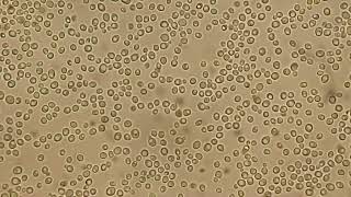 Microscopic Observation of Yeast Cells and Budding in Candida Species [upl. by Isacco28]