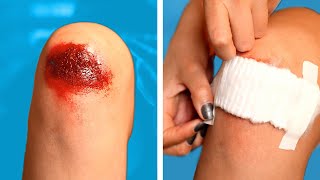 SAFETY HACKS AND FIRST AID 😰  TRUQUES DE PRIMEIROS SOCORROS  Dicas DIY e Situações Divertidas [upl. by Hazard721]