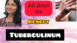 Tuberculinum  Homeopathy  Keynotes  Personality  Cases  Rubrics  Dr Priyanka  Easy Learning [upl. by Osner]