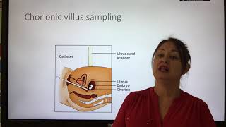 DNA Technology Genetic Screening amp Probes  Alevel Biology  OCR AQA Edexcel [upl. by Demeyer]