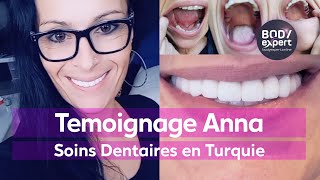 SOINS DENTAIRES  🦷 Témoignage Couronnes et Implants dentaires  BODYEXPERT [upl. by Arykat]