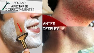 ¿CÓMO AFEITARSE HOMBRES  Consejos para evitar alergias después de rasurar [upl. by Sivartal]