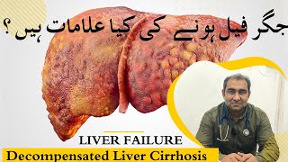 quotUnderstanding Liver Failure and Decompensated Cirrhosis Symptoms Causes and Lifesaving Insightsquot [upl. by Eudocia]