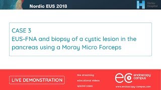 Livedemo  Nordic EUS 2018  EUSFNA and biopsy of a cystic lesion in the pancreas [upl. by Aynotak687]