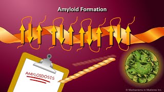 Amyloidosis [upl. by Anyer]