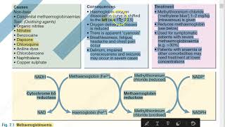 Medicine 157 MetHemoglobinemia [upl. by Sexton]