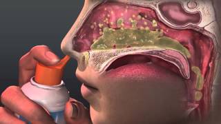 Can Saline Irrigation Help Nasal Allergies Animated Guide to Saline Nasal Irrigation [upl. by Pelagia319]