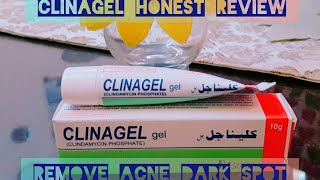 CLINAGEL gel Review Remove pimples acne Acne scarsdark spot [upl. by Rori]