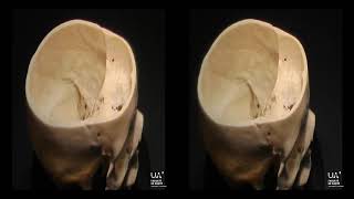 Anatomie 3D de létage moyen de la base du crâne [upl. by Trisha]