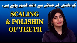 How to Protect teeth  Scaling amp Polishing  Oral Health [upl. by Olumor]