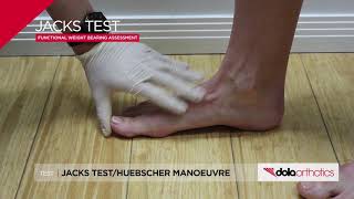 DOLA Orthotics  Clinical Tests Jacks Test [upl. by Ahsemed120]