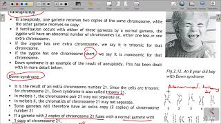 GRADE 12 LIFE SCIENCES CONSEQUENCES OF NON DISJUNCTION OF CHROMOSOMES  ABNORMAL MEIOSIS [upl. by Linder476]