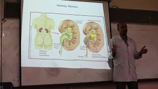 Gout and Hyperuricemia By Dr Dheyaa Jabbar [upl. by Lana]