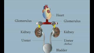 Vesicoureteral Reflux [upl. by Englebert]